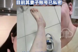 篮球解说员孔祥宇妻子“酥饼”晒出淤青腿照 称遭其家暴 😱